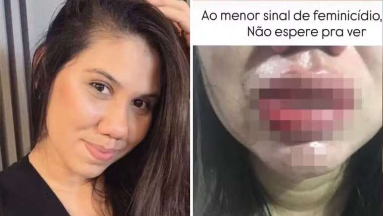 Erica Alves compartilhou foto do lábio machucado após ser agredida