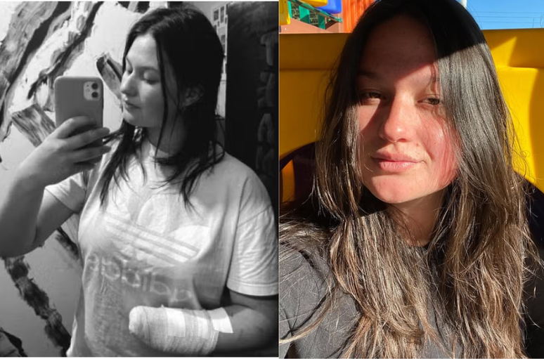 Jovem Kessya Souza, de 18 anos, teve a mão esquerda amputada após ser atacada pelo ex-companheiro em Rio Negrinho (SC)