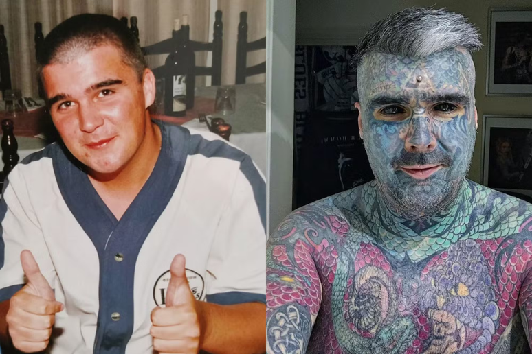 Antes e depois de Matthew Whelan, também conhecido como King of Inkland King Body Art