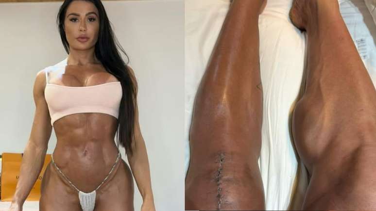Gracyanne Barbosa mostra o corpo após lesão e cirurgia no Dança dos Famosos