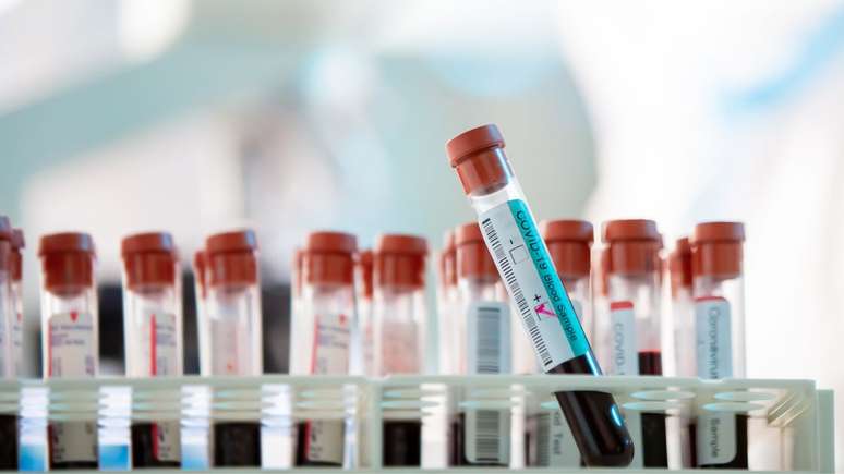 Estudo revela que exames de sangue podem identificar precocemente o risco de infarto e orientar estratégias de prevenção