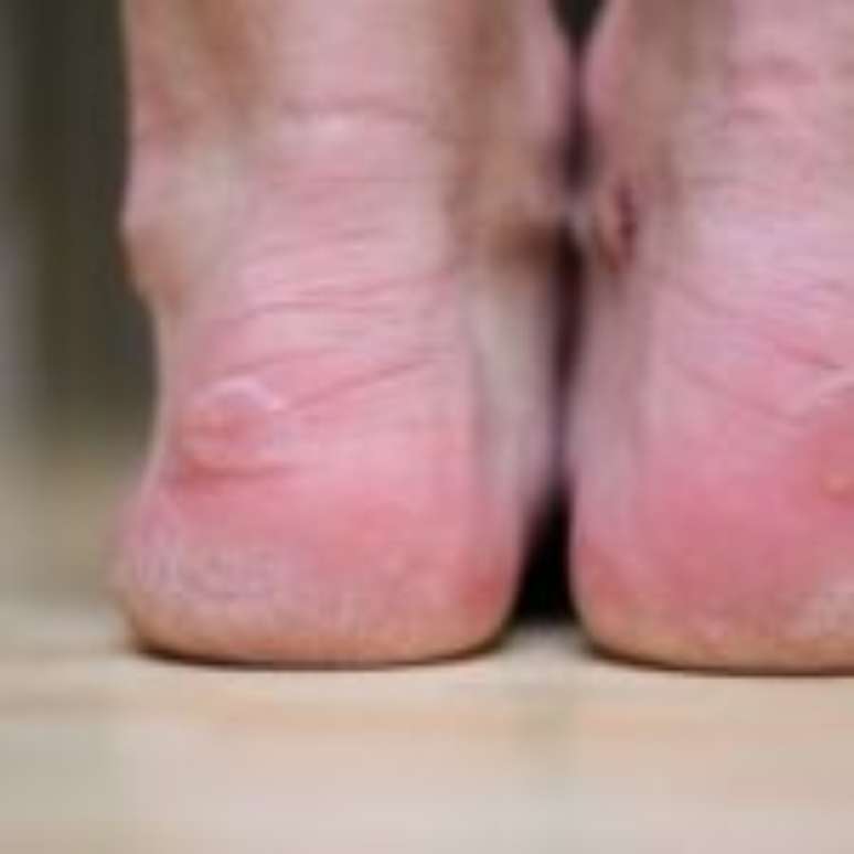 p&eacute; de corredor