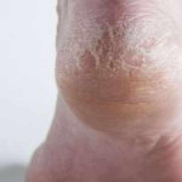 p&eacute; de corredor