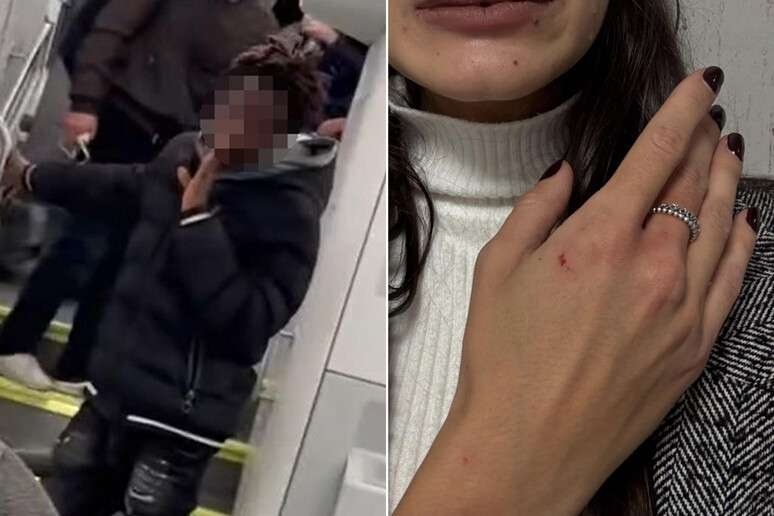 Brasileira disse ter sido agredida por desconhecido