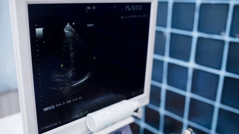 m&eacute;todos de imagem, como ultrassonografia e resson&acirc;ncia magn&eacute;tica, auxiliam na avalia&ccedil;&atilde;o de &oacute;rg&atilde;os afetados &ndash; depositphotos.com / skvalval