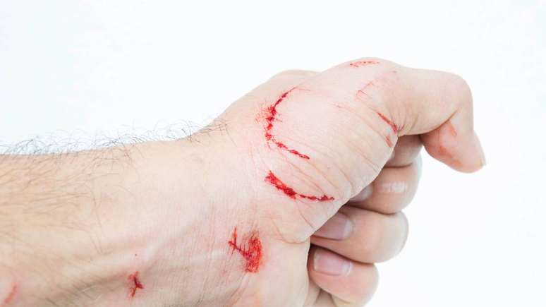 Em caso de mordida ou arranhão, lave o ferimento com água e sabão e procure atendimento médico imediatamente – depositphotos.com / mydegage