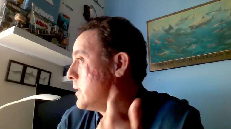 Hoyos mostra com orgulho a cicatriz deixada pelo tubarão: 'marca de batalha com forma de brânquias'