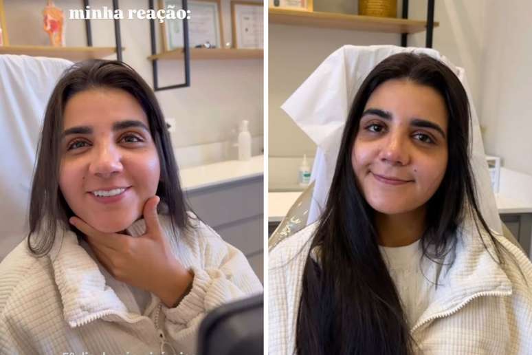 Cantora Yasmin Santos reage ao resultado da cirurgia no nariz