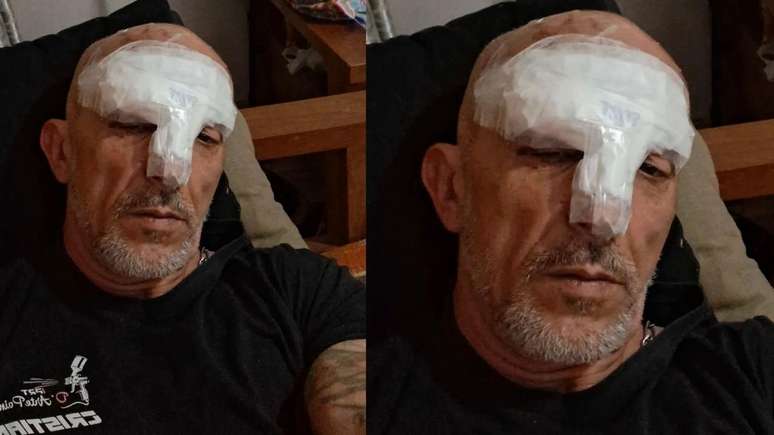 Sentenced to 40 years for murder and attempted bribery, he is recovering at home with 15 stitches on his face.