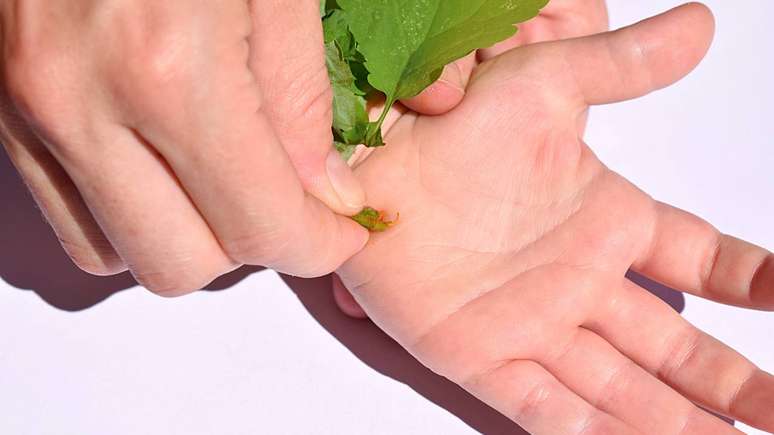 Muitos indiv&iacute;duos recorrem a m&eacute;todos caseiros para remo&ccedil;&atilde;o de verrugas, como uso de fitas adesivas ou produtos naturais. No entanto, especialistas alertam que essas estrat&eacute;gias podem aumentar o risco de infec&ccedil;&otilde;es ou deixar cicatrizes &ndash; depositphotos.com / KVM50