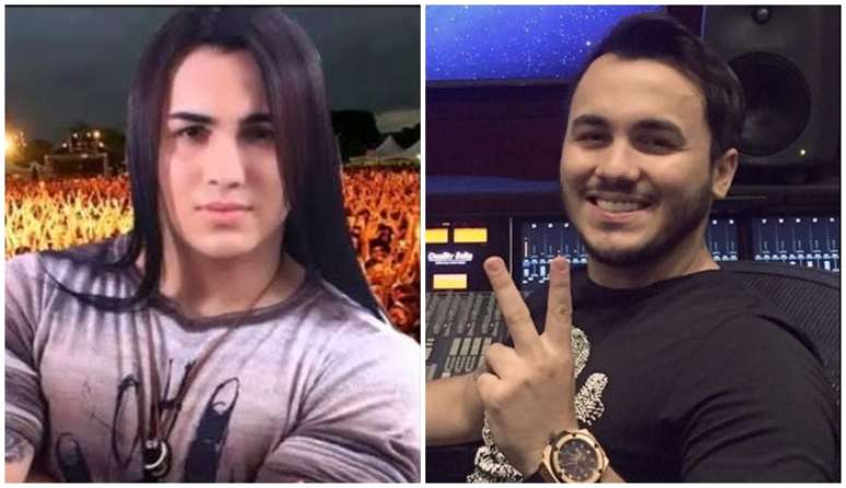 Antes da alopecia, Wallas tinha cabelos volumosos e longos; ao lado, percebe-se a calvície frontal resultante do distúrbio