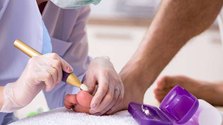 Em casos específicos, profissionais de saúde podem recomendar a combinação de tratamentos ou até a realização de procedimentos, como lixamento supervisionado da unha infectada, visando favorecer a penetração dos medicamentos – depositphotos.com / Elnur_