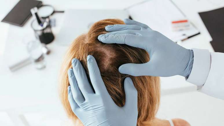 caspa – depositphotos.com / AndrewLozovyi