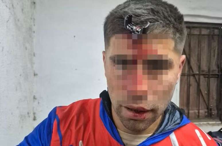 Volante argentino fica ferido após confusão em jogo feminino sub-16 –