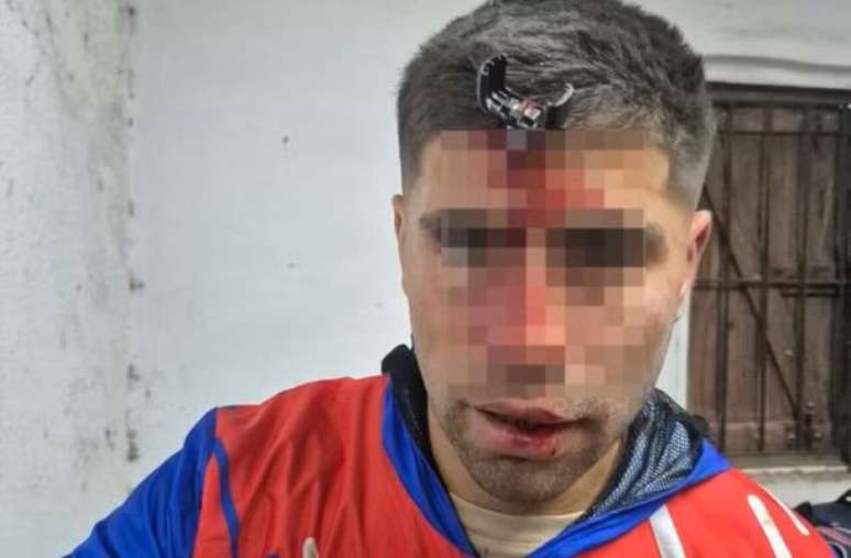 Volante argentino fica ferido após confusão em jogo feminino sub-16 –