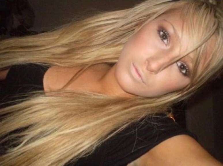 Mary Magdalene antes das cirurgias 