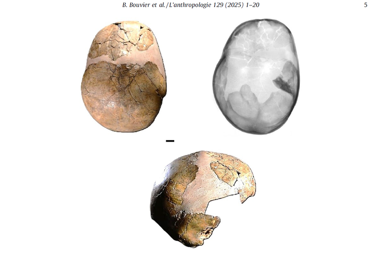 Imagens do cr&acirc;nio de Skhūl 1&deg;
