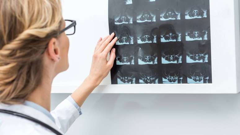 ஈஸ்ட்ரோஜனின் மிகவும் ஆய்வு செய்யப்பட்ட அம்சங்களில் ஒன்று எலும்பு பாதுகாப்பு ஆகும், ஏனெனில் ஹார்மோன் நேரடியாக கால்சியம் வளர்சிதை மாற்றத்தில் பங்கேற்கிறது, ஆஸ்டியோபோரோசிஸ் அபாயத்தைக் குறைக்கிறது - depositphotos.com / IgorVetushko