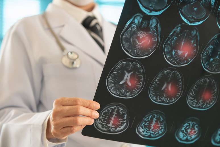 Terapias celulares estão abrindo portas para uma nova geração de tratamentos em medicina regenerativa que buscam substituir ou reparar tecidos danificados, introduzindo novas células capazes de sobreviver, amadurecer e desempenhar as funções perdidas. create jobs 51/Shutterstock