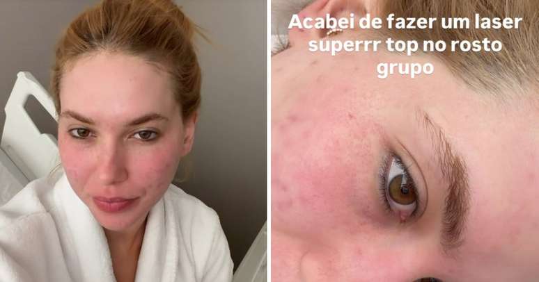 மீட்பு செயல்முறை 30 நாட்கள் வரை ஆகும் என்று மருத்துவர் விளக்கினார்