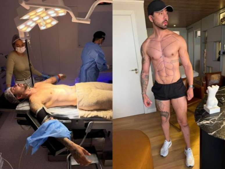 வயிறு மற்றும் கால்களை 