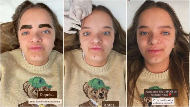 Rafa Justus mostra antes e depois de procedimento nas sobrancelhas