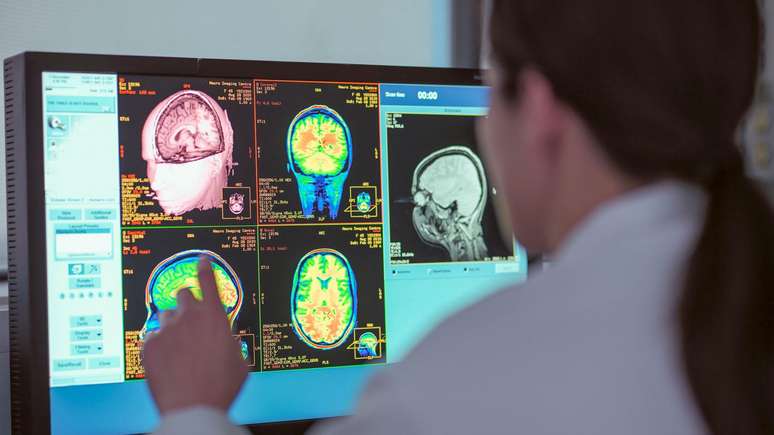 மூளை வளர்ச்சியில் ஐந்து வெவ்வேறு கட்டங்களை ஆராய்ச்சியாளர்கள் கண்டறிந்துள்ளனர்