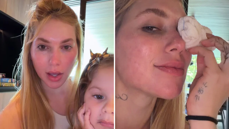 É grave? Virginia machuca o olho durante brincadeira com a filha / Reprodução: Instagram