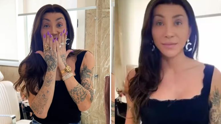 Maya Massafera retira ossos do maxilar e mostra resultado nas redes sociais: ‘Não assustem’