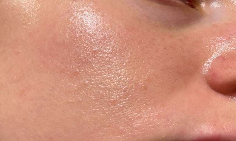 Oily skin? A dermatologist explains what your skin care routine should look like
