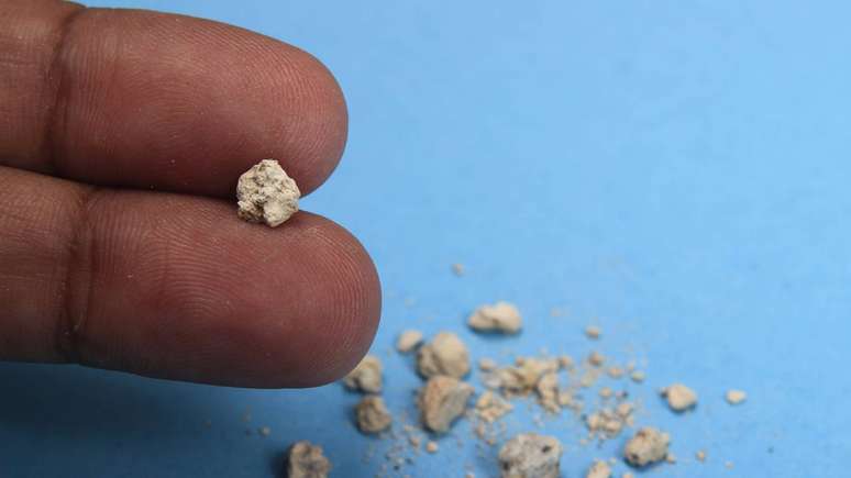 Saiba como aliviar a dor e prevenir novos casos: hidratação adequada, alimentação equilibrada e acompanhamento médico regular são essenciais – depositphotos.com / stioss