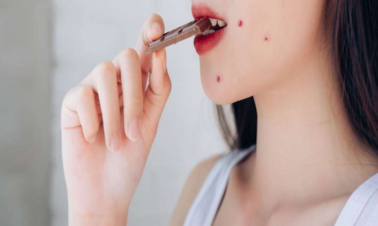 Chocolate dá espinha? Entenda o que diz a ciência