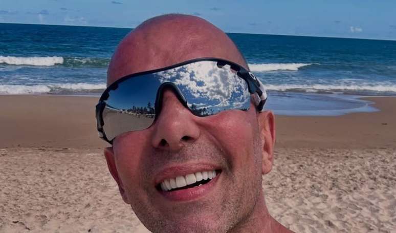 'Mais de 12 mil fios de cabelo': médico explica transplante capilar de Rafael Ilha, diagnosticado com calvície avançada em grau 7.