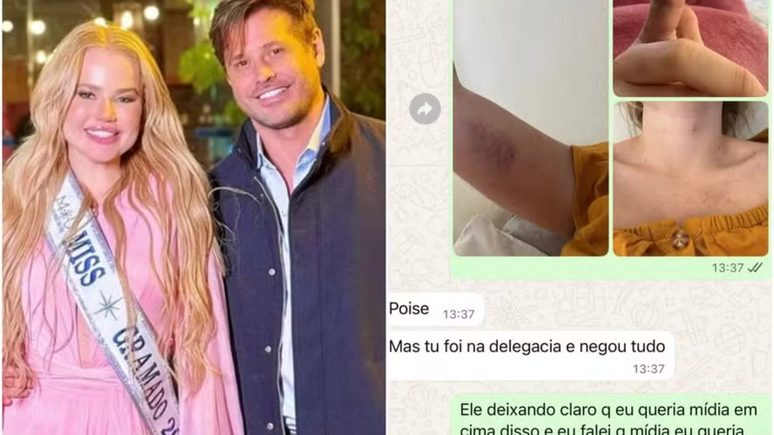 Prints! Ex de Dado Dolabella revela que sofreu diversas agressões do ator / Reprodução: Instagram
