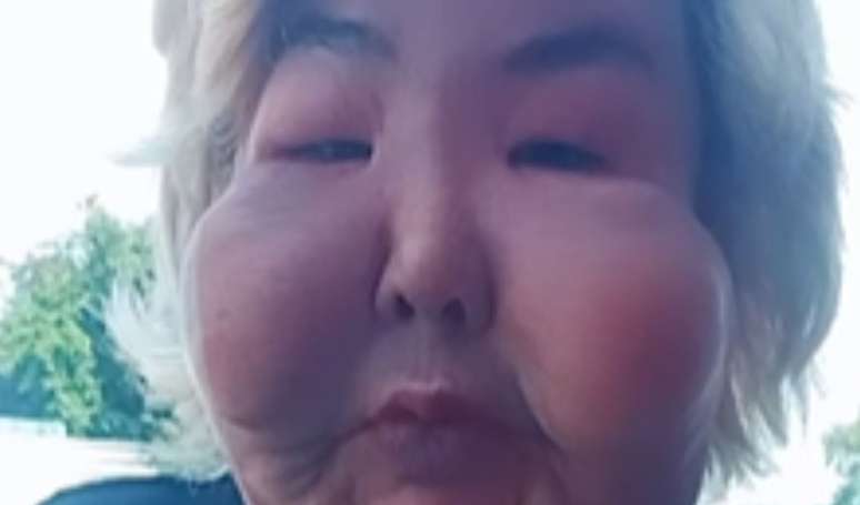 Quem é a Juju do Pix? Influenciadora que viralizou por injetar óleo mineral no rosto rebate críticas: 'Não tenho culpa de ter...'.