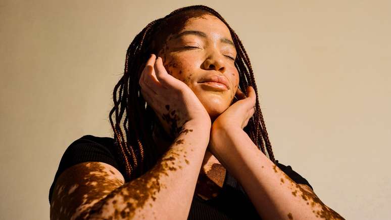 Acredita-se que a melanina, o pigmento que dá cor à pele mais escura, seja o fator fundamental para o desenvolvimento do mofo de Chernobyl