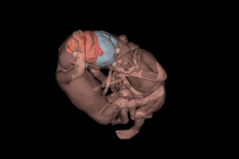 A tecnologia 3D oferece precisão para decisões vitais, enquanto a inteligência artificial pavimenta o caminho para a medicina 4.0, garantindo cirurgias fetais ou neonatais mais seguras e previsíveis.