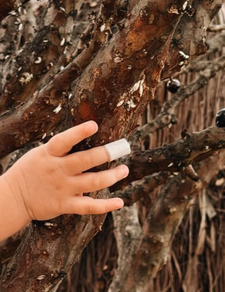 Amanda Kimberlly mostra curativo na m&atilde;o da filha ap&oacute;s menina se recuperar de fratura externa