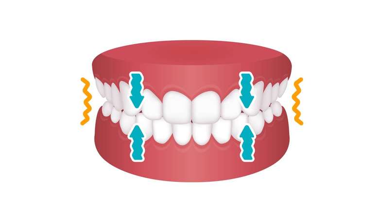 Ranger noturno pode ser tão intenso que só é percebido pelos ruídos durante o sono – depositphotos.com / barks