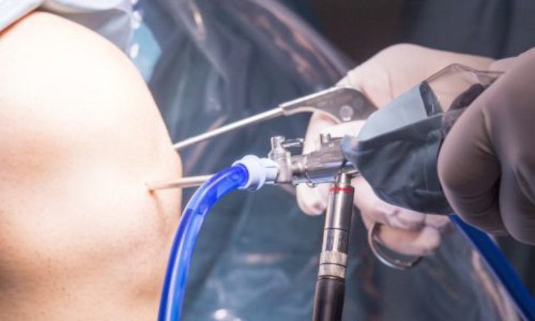 artroscopia – Reprodução