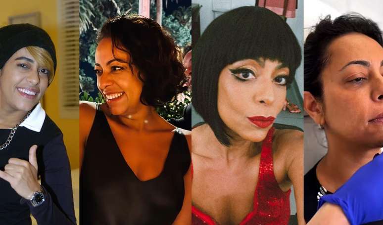 Samantha Schmütz antes e depois: veja a transformação da atriz desde a 'Zorra Total' até os procedimentos recentes com médico de Kim Kardashian.