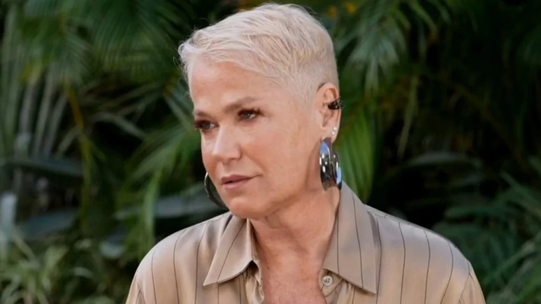 Médico explica quadro de saúde de Xuxa e motivo de cirurgia / Reprodução