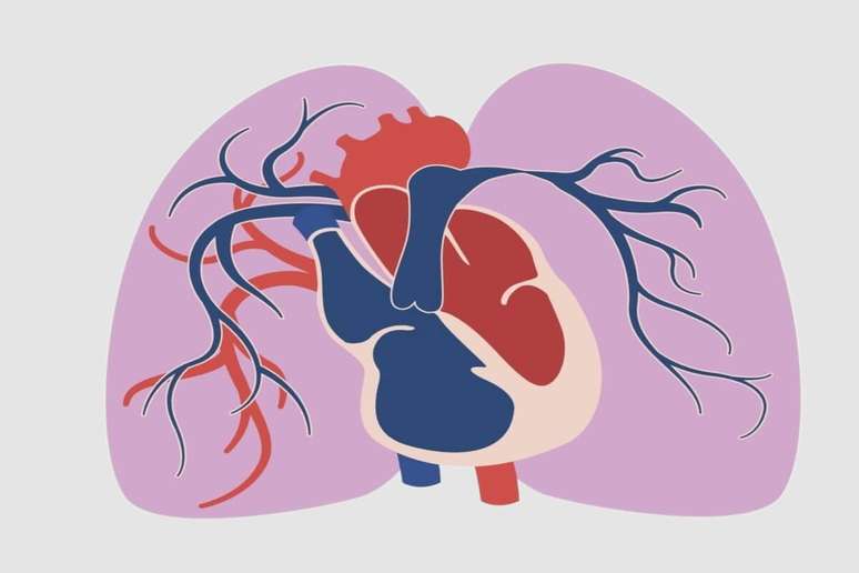 A hipertensão arterial pulmonar é uma doença rara e grave