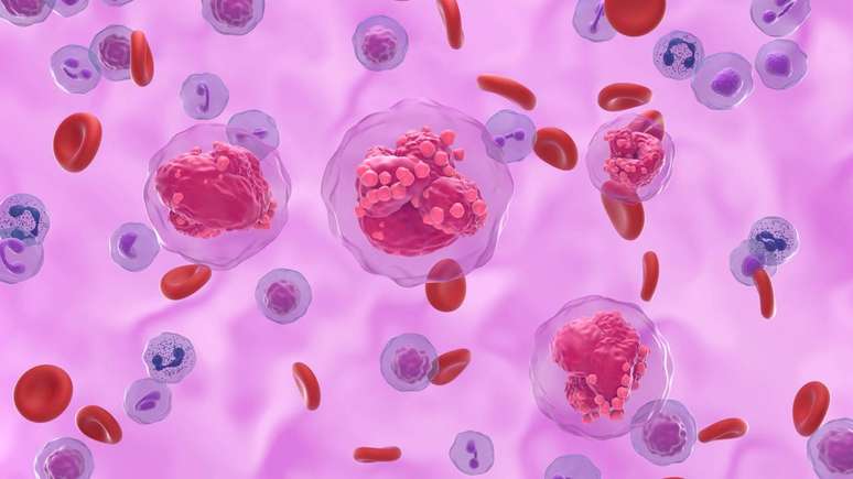 Esse tipo de leucemia afeta as chamadas células T, uma classe de glóbulos brancos responsável por identificar e eliminar ameaças, como vírus e células alteradas – depositphotos.com / forfour