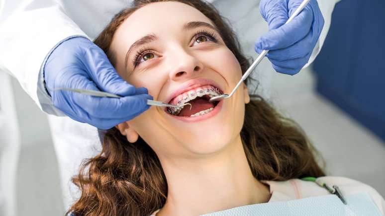 Ajustes odontol&oacute;gicos, ortodontia e placa de bruxismo ajudam a corrigir a oclus&atilde;o e proteger os dentes contra danos progressivos &ndash; depositphotos.com / AndrewLozovyi