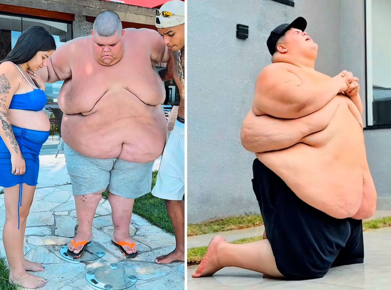 Gord&atilde;o da XJ antes e depois de perder 100kg