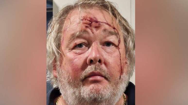 Christopher Mills foi brutalmente espancado com uma arma