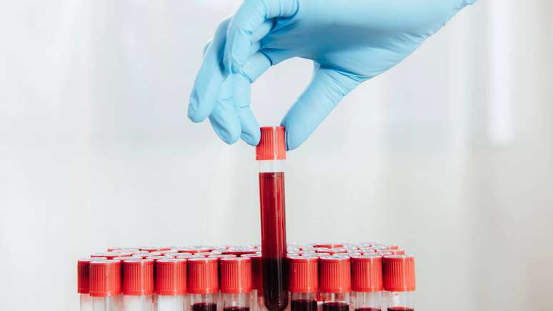 Ao pensar em seguir a dieta do grupo sangu&iacute;neo, alguns cuidados costumam ser relevantes &ndash; depositphotos.com / MicEnin