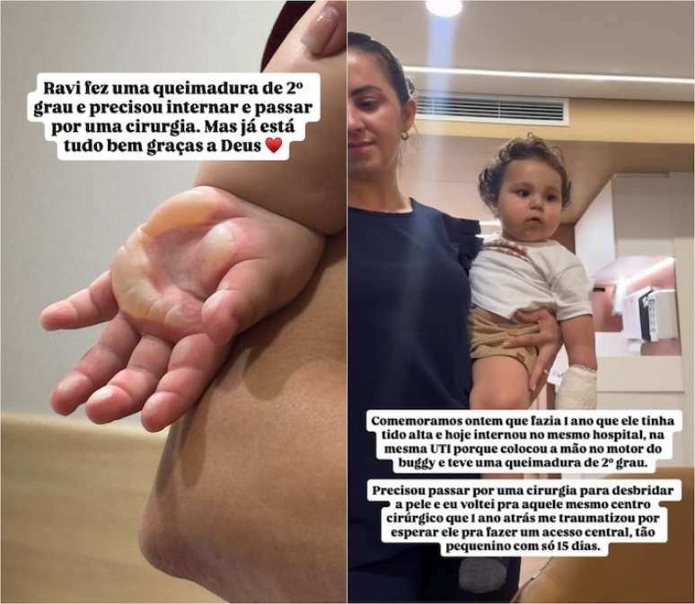 Ravi precisou passar por cirurgia de urg&ecirc;ncia ap&oacute;s o acidente