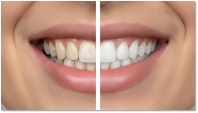 Imagem fornecida: Refer&ecirc;ncia:  Resultados  